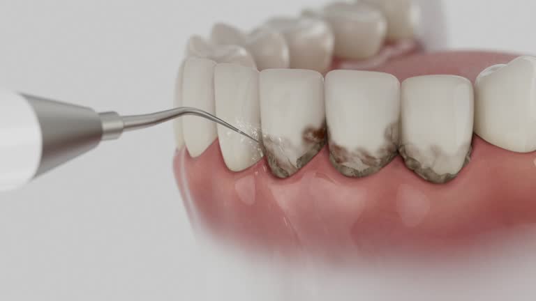 Reliable Wisdom Tooth Removal contractor in Moore County County, TN by Dentist Open Now